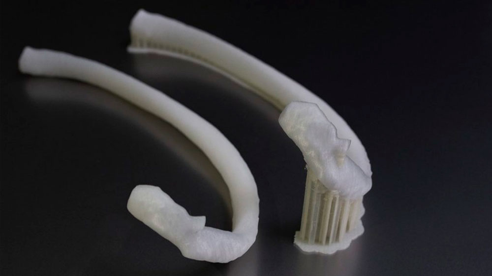3D-печатное ребро, созданное для имплантации в Болгарии