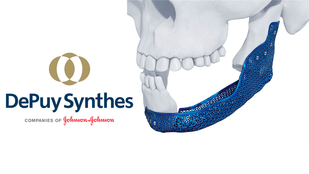 Логотип Johnson & Johnson та DePuy Synthes на тлі 3D-друкованих медичних виробів