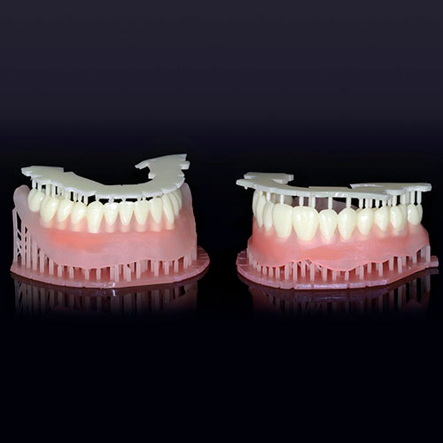  зубні протези на 3Д-принтері 